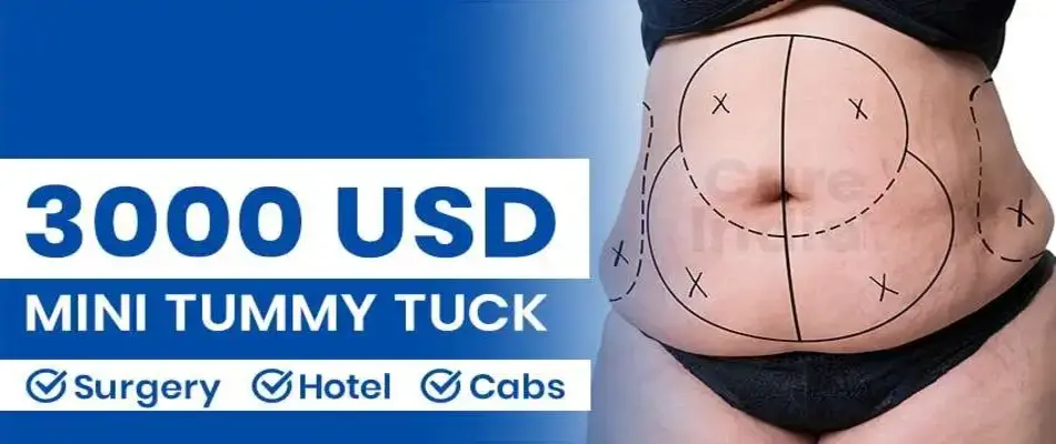 Mini Tummy Tuck Cost